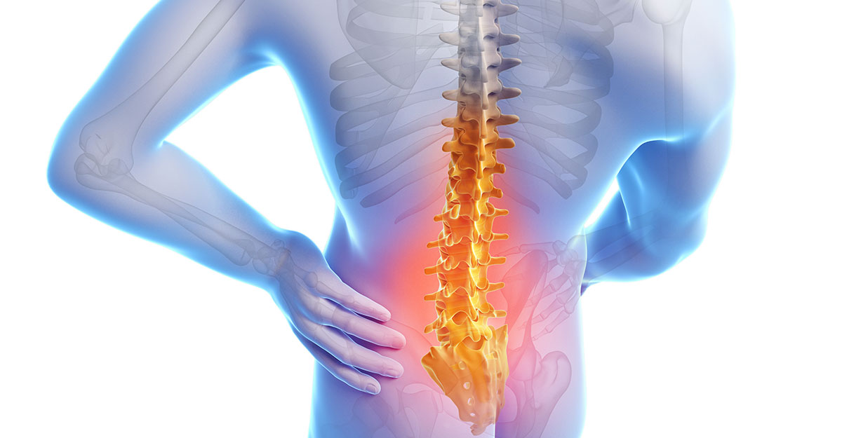 Featured image for Downtown St. Louis, MO Back Pain Treatment