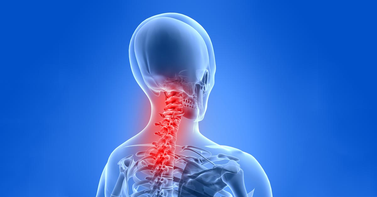 Downtown St. Louis, MO car accident and neck pain treatment